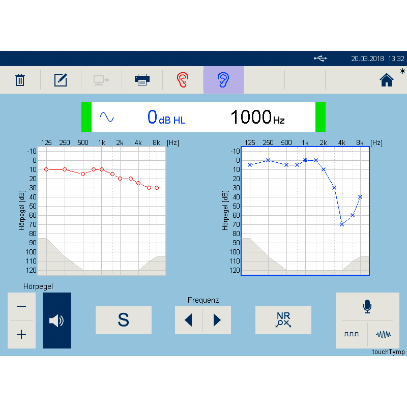 xtouchtymp_mi_26_1_800x800